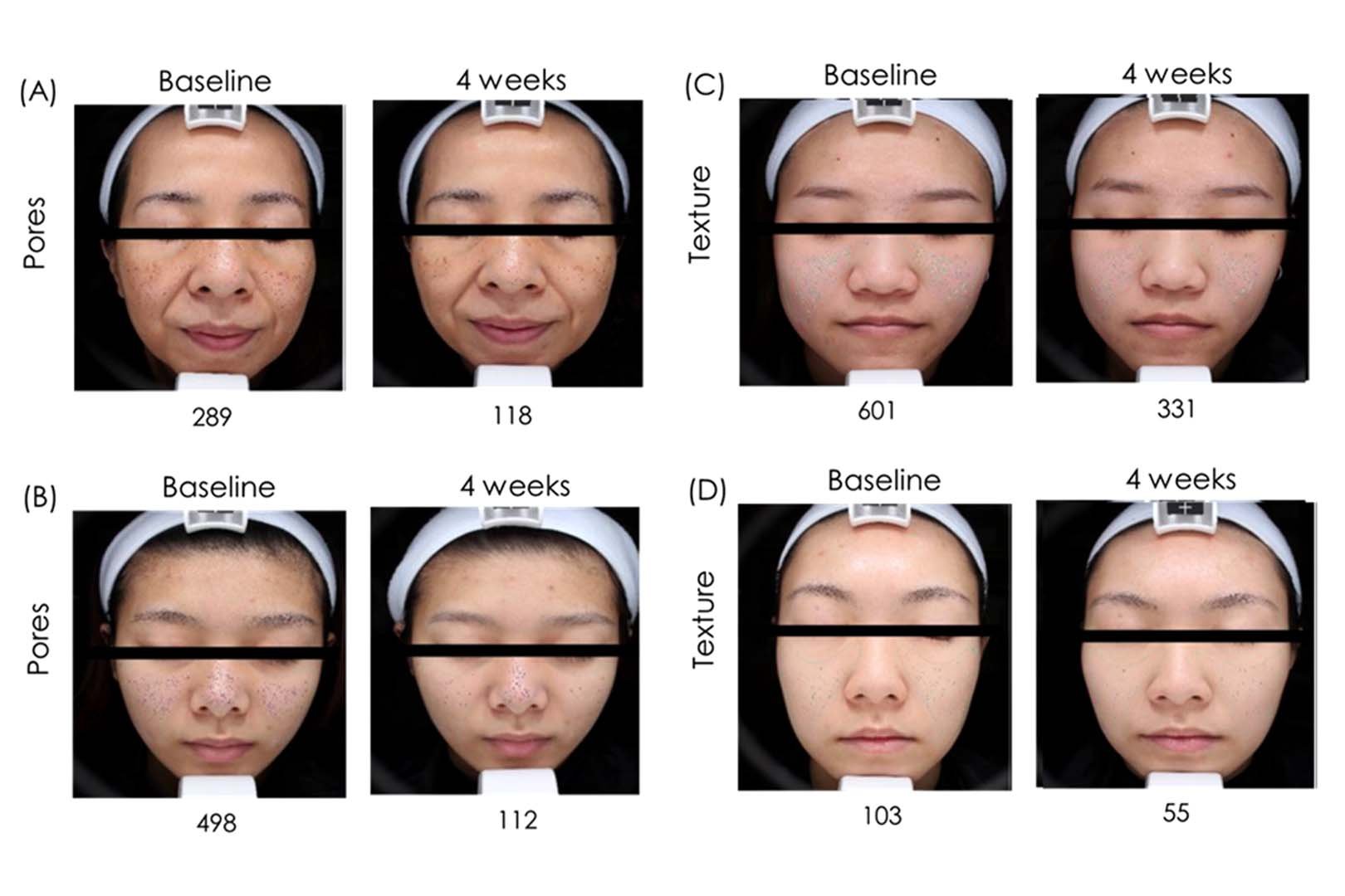 Astrion Study Reference Pictures